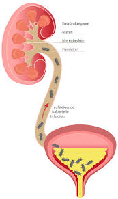 Typische Symptome Bei Blasenentzundung Zystitis