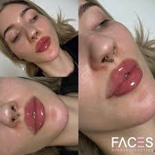 Best Facial Balancing in Nyc