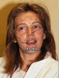 Model Marla Hanson Now