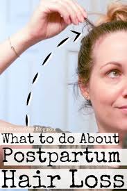 Pricing, promotions and availability may vary by location and at target.com. Postpartum Hair Loss How To Deal The Soccer Mom Blog