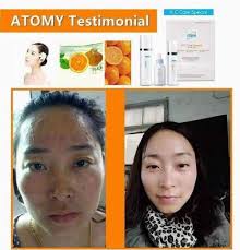 ATOMY a way of life .