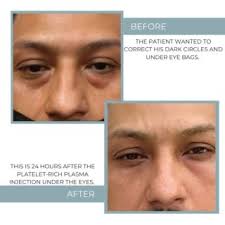 Hours, accepts credit cards, parking, by appointment only. Ipl Triangle Eye Institute