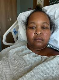 Bariatric surgery weight loss progress