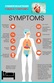 Pin On Heartburn Symptoms