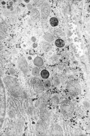 It produces the membranes that surround the lysosomes. Lysosomes An Overview Sciencedirect Topics