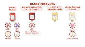 Image result for Plasma Transfusion