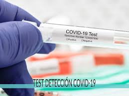 Optimización la pcr es una técnica de gran sensibilidad, necesita una mínima cantidad de adn para obtener un gran número de copias. Test Deteccion De Coronavirus En Vigo Analisis Para Covid 19 Iconica Servicios Medicos