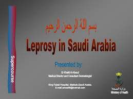 Contact email of director genaral in all foods items @gmail.com @hotmail.com. Ppt Ø¨Ø³Ù… Ø§Ù„Ù„Ø© Ø§Ù„Ø±Ø­Ù…Ù† Ø§Ù„Ø±Ø­ÙŠÙ… Leprosy In Saudi Arabia Powerpoint Presentation Id 510711