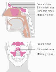 Polyps not only complicate nasal breathing of the patient. New Device To Combat Nasal Polyps Makes West Coast Debut Newsroom