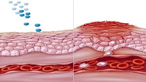 علاج الحكة الجلدية المزمنة وأهم وصفات طبيعية لعلاج الحكة المزمنة – زيادة