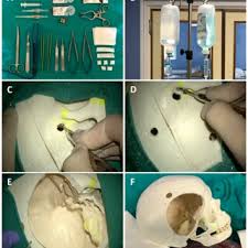 Materials, instruments, and infrastructure requirements for the human...