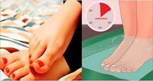 Calo Na Sola Do Pé O Que Fazer Com Esta Receita Seus Pes Vao Ficar Macios Como Os De Uma Adolescente Cura Pela Natureza Saude E Beleza Tratamento Cuidados Com Os Pes