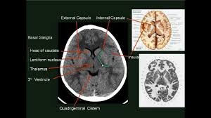 Normal Brain Ct Mri Imaging In Arabic Prof Dr Mamdouh Mahfouz Youtube