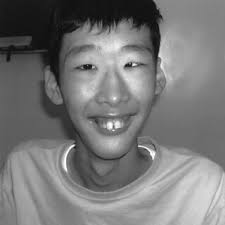 PDF) Microcephaly, Cerebellar Atrophy, and Focal Segmental  Glomerulosclerosis in Two Brothers: A Possible Mild Form of Galloway-Mowat  Syndrome