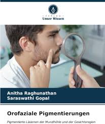 Amazon.com: Orofaziale Pigmentierungen: Pigmentierte Läsionen der Mundhöhle  und der Gesichtsregion (German Edition): 9786206940111: Raghunathan, Anitha,  Gopal, Saraswathi: Books