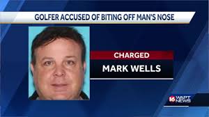 Golfer accused of biting man’s nose off