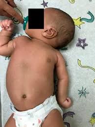 We did not find results for: Jbjs Team Approach Management Of Brachial Plexus Birth Injury