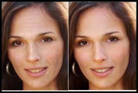 Original image (left), retouched image (right) [26]