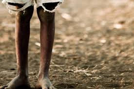 Resultado de imagem para foto de crianÃ§a pobre