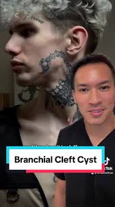 The Guy That Has Liquid Coming Out of His Neck with A Scorpion Tattoo