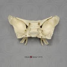 This bone is the center of attention in endonasal skull base surgery. Human Sphenoid Bone Clones Inc Osteological Reproductions