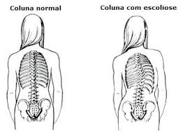Resultado de imagem para radiografia de coluna cervical torácica e lombar com laudo