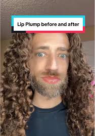 Lip Plumping Transformation: Before and After Results