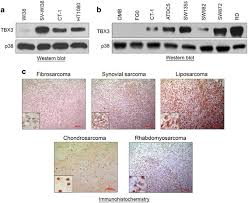 Ong menyarankan bagi yang melanggar bakal dikenakan denda sebesar 10.000 ringgit malaysia atau setara dengan rp 34 jutaan. The T Box Transcription Factor 3 Is A Promising Biomarker And A Key Regulator Of The Oncogenic Phenotype Of A Diverse Range Of Sarcoma Subtypes Oncogenesis