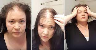 Nervous Woman Goes To Reveal Her Thinning Hair But Ends Up With A Whole New Look Thin Hair Styles For Women Hair Color For Women Hair Loss Women
