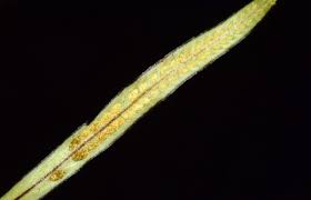 Image result for Grammitis