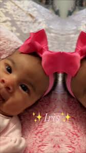 Iris Beautiful Smile🥰