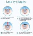 SMILE Eye Surgery Cost: An In-Depth Guide | Manhattan Eye