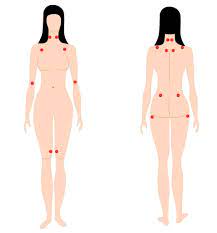 Fibromyalgie Schmerzen Am Ganzen Korper Liebscher Bracht