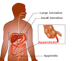 Pin On Where Is Your Appendix