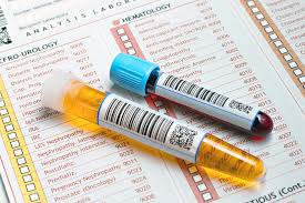 None of this is ideal, but some causes of bloody urine are more serious. Conditions That Can Cause Blood In Your Urine