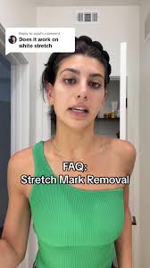 Stretch Mark Hair Feather