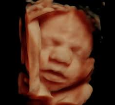 Image result for tbn:T5UajvfpShvp6M::www.photoslinks.com/index.php%3Foption%3Dcom_joomgallery%26func%3Dwatermark%26catid%3D4%26id%3D23%26Itemid%3D2