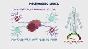 Neurogenic shock: Video & Meaning | Osmosis