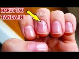 Pelatihan kartu nail art monogram. Download Tanda Sabit Di Kuku Menunjukkan Kondisi Kesehatan Anda Mp4 Mp3 3gp Naijagreenmovies Fzmovies Netnaija
