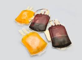 Image result for Plasma Transfusion