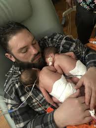 My s/o holding our identical twin girls, born premature at 30 weeks,  together for the first time. They're a month old today. : r/aww