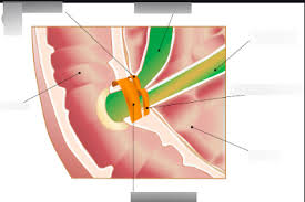 Sphincter of oddi dysfunction is a rare condition affecting the digestive system. The Hepatopancreatic Sphincter Of Oddi Diagram Quizlet