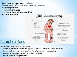 Lyme Disease Online Presentation