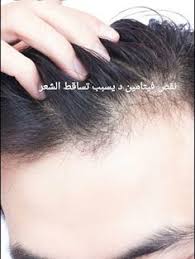 نقص فيتامين د يسبب تساقط الشعر Ear Tattoo Behind Ear Tattoo Ear