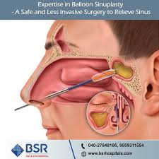 Endoscopic Sinus Surgery Is Safe When Performed By An Experienced Surgeon Ent Surgeons At Bsr Hospital Hav Sinus Surgery Face Yoga Facial Exercises Sinusitis