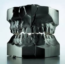 How much does it cost to remove wisdom teeth in india. Why We Have So Many Problems With Our Teeth Scientific American