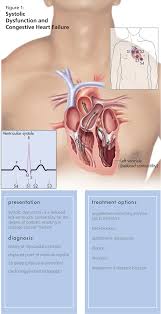 Image result for Point of Maximum Impulse
