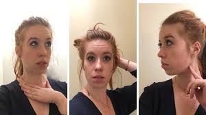 Maybe you would like to learn more about one of these? Do You Think Buccal Fat Pad Removal Would Be The Correct Procedure To Slim And Define My Face Plasticsurgery