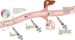 Dna analysis os answer key. Liquid Biopsy Enters The Clinic Implementation Issues And Future Challenges Nature Reviews Clinical Oncology