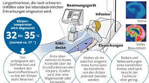 Medizin Wie Gefahrlich Ist Das Kunstliche Koma Welt